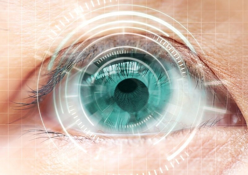 Post-LASIK Ectasia